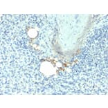 Immunohistochemistry - Anti-Tartrate Resistant Acid Phosphatase Antibody [ACP5/1070] - BSA and Azide free (A252867) - Antibodies.com