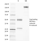 SDS-PAGE - Anti-Tartrate Resistant Acid Phosphatase Antibody [ACP5/1070] - BSA and Azide free (A252868) - Antibodies.com