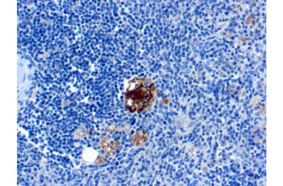 Immunohistochemistry - Anti-Tartrate Resistant Acid Phosphatase Antibody [SPM601] - BSA and Azide free (A252868) - Antibodies.com