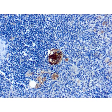 Immunohistochemistry - Anti-Tartrate Resistant Acid Phosphatase Antibody [SPM601] - BSA and Azide free (A252868) - Antibodies.com