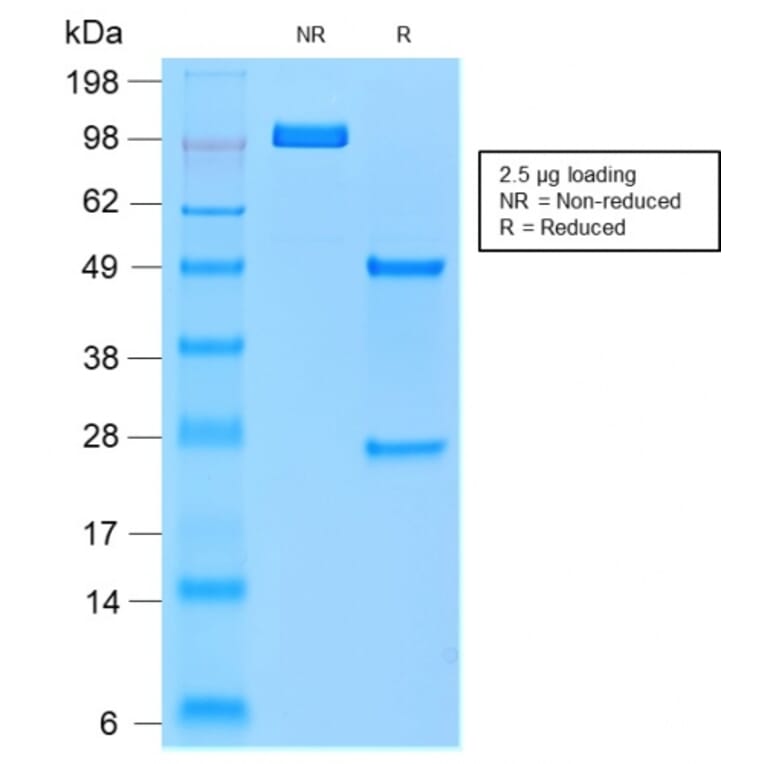 SDS-PAGE - Anti-Tartrate Resistant Acid Phosphatase Antibody [rACP5/1070] - BSA and Azide free (A252870) - Antibodies.com