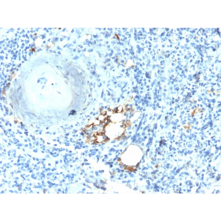 Immunohistochemistry - Anti-Tartrate Resistant Acid Phosphatase Antibody [ACP5/2336R] - BSA and Azide free (A252870) - Antibodies.com