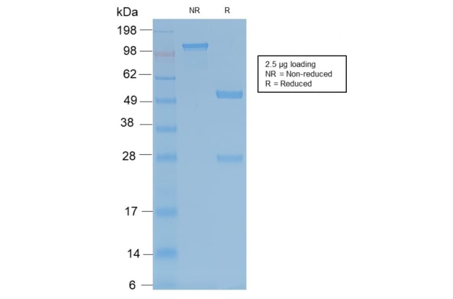 SDS-PAGE - Anti-Tartrate Resistant Acid Phosphatase Antibody [ACP5/2336R] - BSA and Azide free (A252871) - Antibodies.com