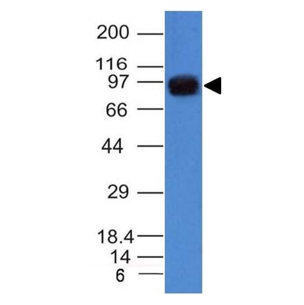 Western Blot - Anti-UACA Antibody [UACA/1222] - BSA and Azide free (A252872) - Antibodies.com