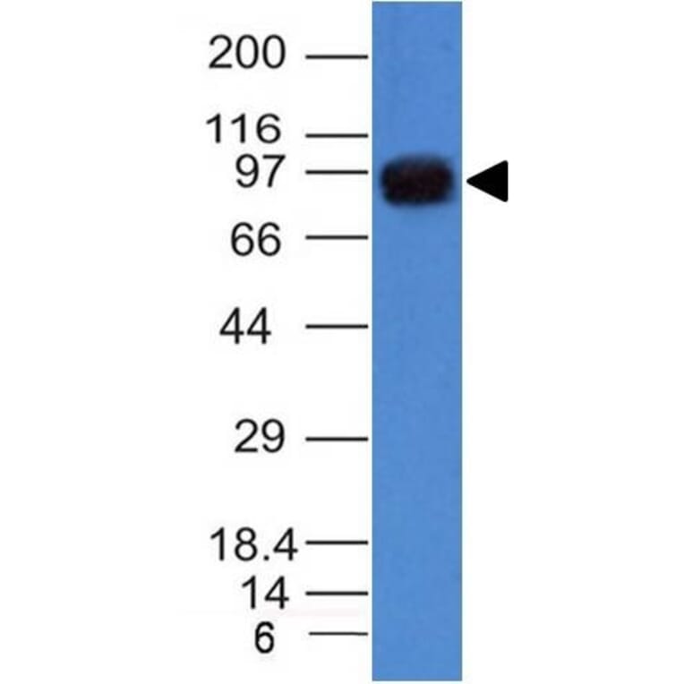 Western Blot - Anti-UACA Antibody [UACA/1222] - BSA and Azide free (A252872) - Antibodies.com