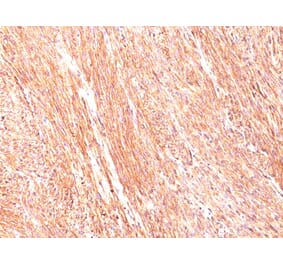 Immunohistochemistry - Anti-TMEM16A Antibody [DG1/447] - BSA and Azide free (A252873) - Antibodies.com