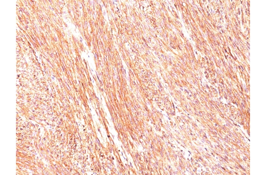 Immunohistochemistry - Anti-TMEM16A Antibody [DG1/447] - BSA and Azide free (A252873) - Antibodies.com