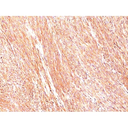 Immunohistochemistry - Anti-TMEM16A Antibody [DG1/447] - BSA and Azide free (A252873) - Antibodies.com