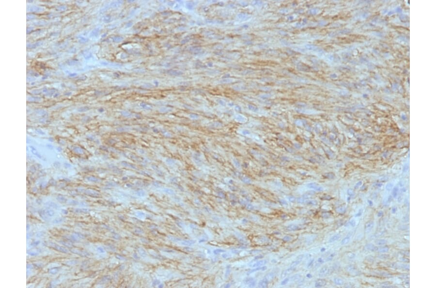 Immunohistochemistry - Anti-TMEM16A Antibody [SPM580] - BSA and Azide free (A252874) - Antibodies.com