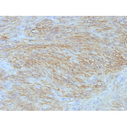 Immunohistochemistry - Anti-TMEM16A Antibody [SPM580] - BSA and Azide free (A252874) - Antibodies.com