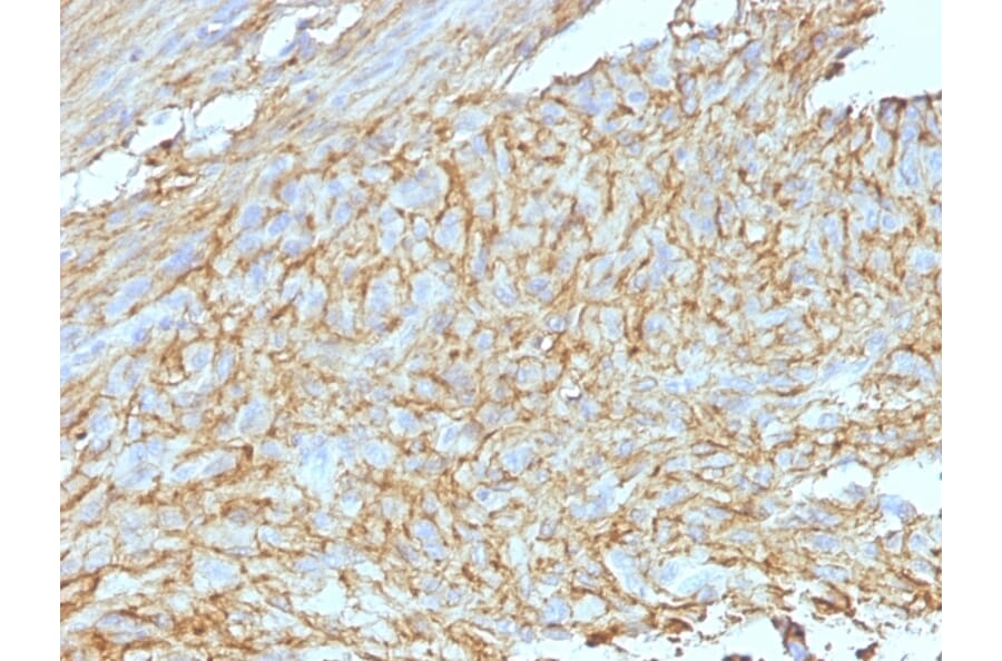 Immunohistochemistry - Anti-TMEM16A Antibody [DG1/447 + DOG-1.1] - BSA and Azide free (A252876) - Antibodies.com