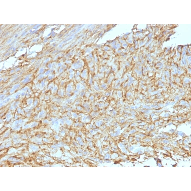 Immunohistochemistry - Anti-TMEM16A Antibody [DG1/447 + DOG-1.1] - BSA and Azide free (A252876) - Antibodies.com