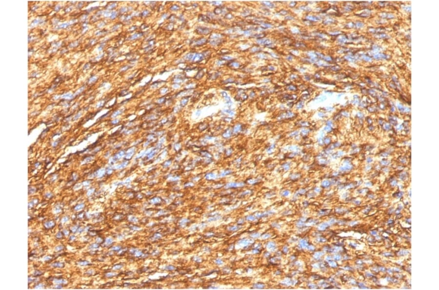 Immunohistochemistry - Anti-TMEM16A Antibody [DG1/1484] - BSA and Azide free (A252878) - Antibodies.com