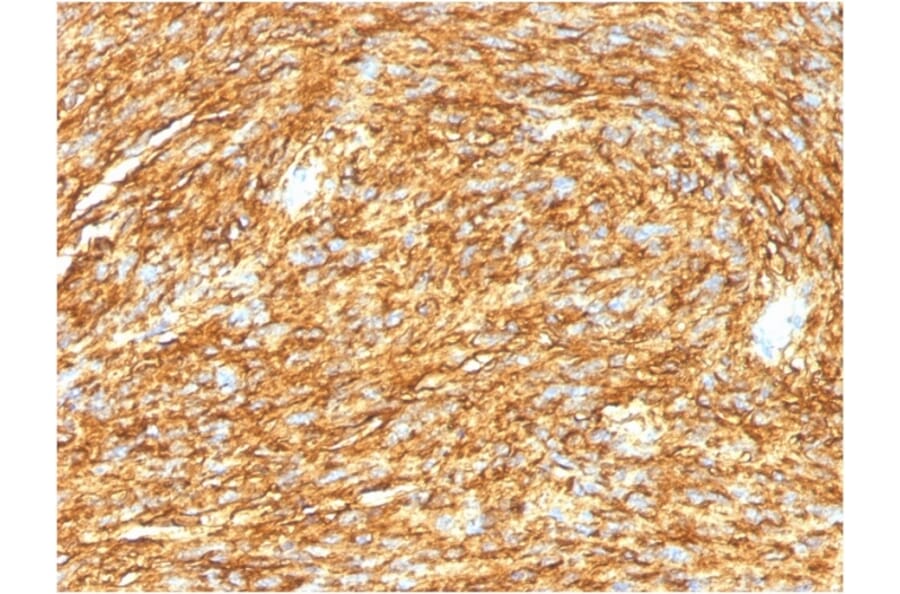 Immunohistochemistry - Anti-TMEM16A Antibody [DG1/1485] - BSA and Azide free (A252879) - Antibodies.com
