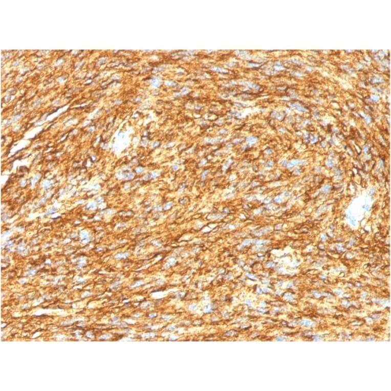 Immunohistochemistry - Anti-TMEM16A Antibody [DG1/1485] - BSA and Azide free (A252879) - Antibodies.com