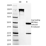 SDS-PAGE - Anti-TMEM16A Antibody [DG1/1485] - BSA and Azide free (A252879) - Antibodies.com