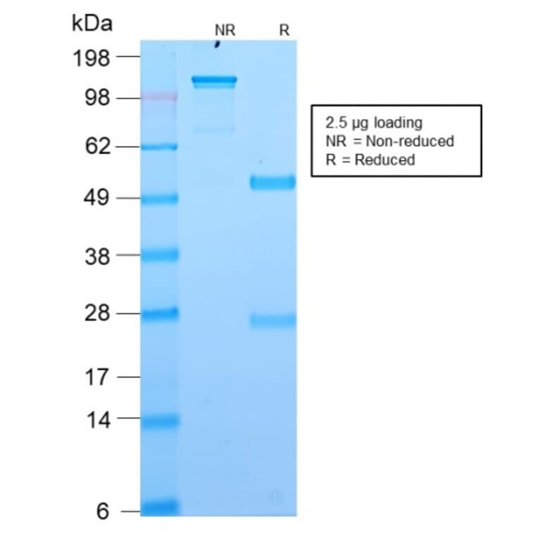 SDS-PAGE - Anti-TMEM16A Antibody [DG1/2564R] - BSA and Azide free (A252882) - Antibodies.com