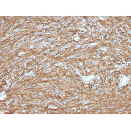 Immunohistochemistry - Anti-TMEM16A Antibody [DG1/2831R] - BSA and Azide free (A252882) - Antibodies.com