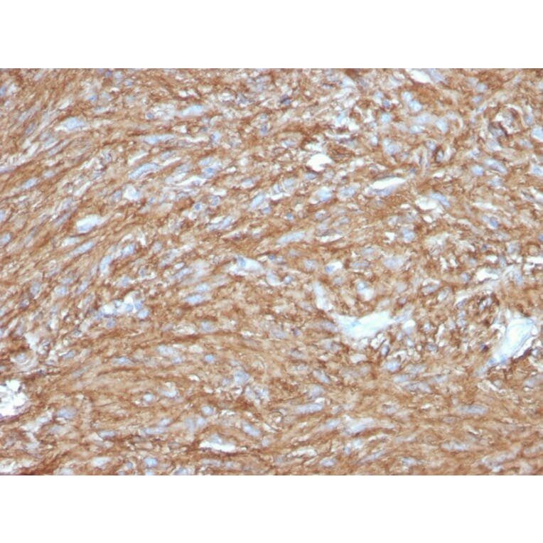 Immunohistochemistry - Anti-TMEM16A Antibody [DG1/2831R] - BSA and Azide free (A252882) - Antibodies.com