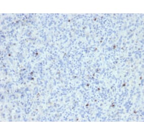 Immunohistochemistry - Anti-Perforin Antibody [SPM434] - BSA and Azide free (A252890) - Antibodies.com