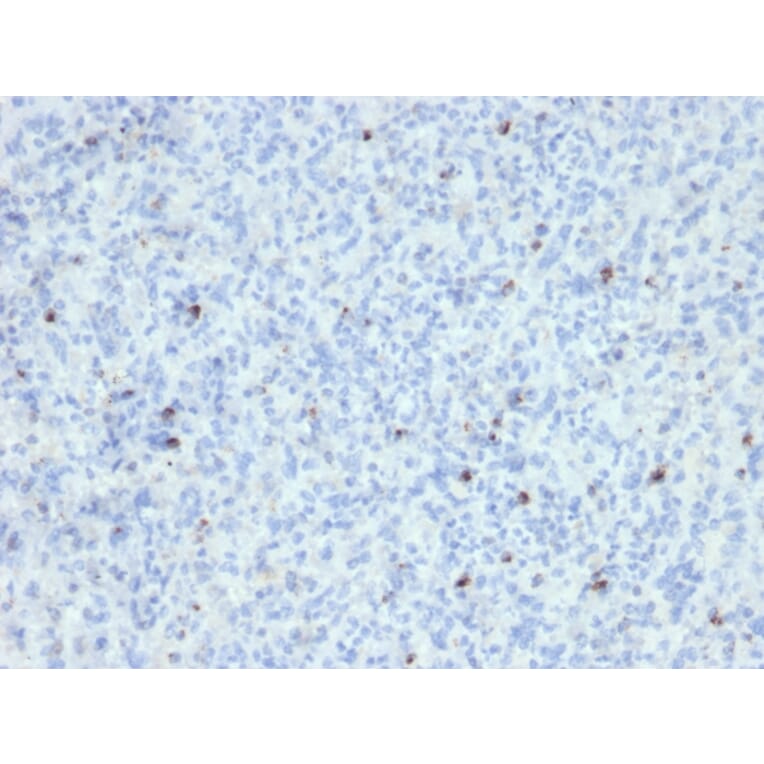 Immunohistochemistry - Anti-Perforin Antibody [SPM434] - BSA and Azide free (A252890) - Antibodies.com