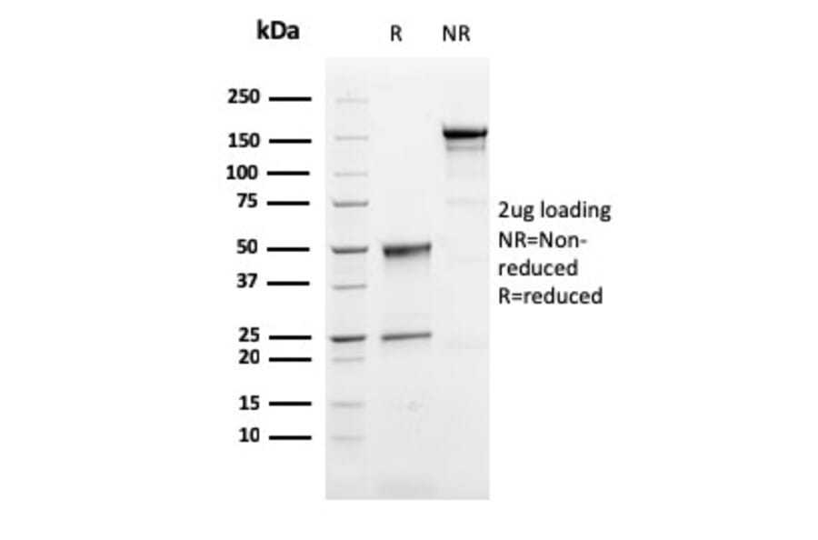 SDS-PAGE - Anti-Perforin Antibody [PRF1/2468] - BSA and Azide free (A252892) - Antibodies.com