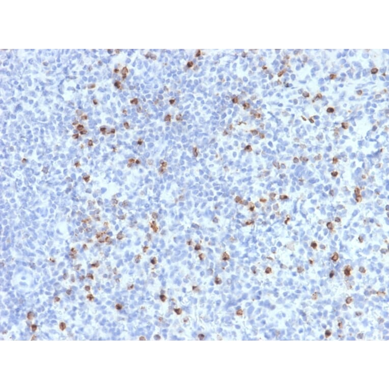 Immunohistochemistry - Anti-Perforin Antibody [PRF1/2470] - BSA and Azide free (A252893) - Antibodies.com