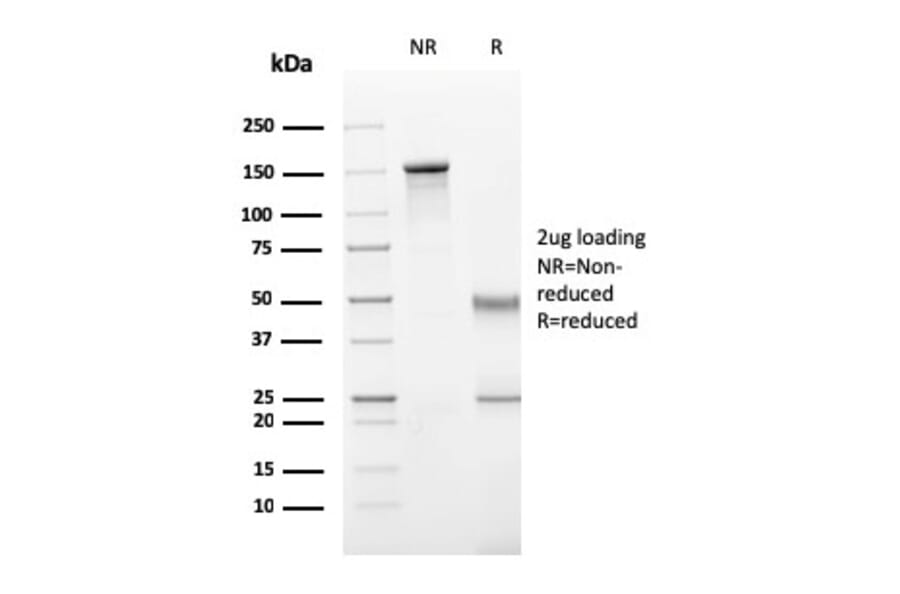 SDS-PAGE - Anti-Perforin Antibody [PRF1/2470] - BSA and Azide free (A252893) - Antibodies.com