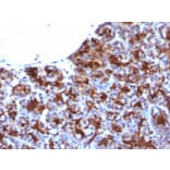 Immunohistochemistry - Anti-MAML3 Antibody [MAML3/1303] - BSA and Azide free (A252894) - Antibodies.com