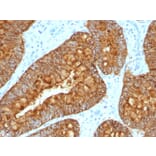 Immunohistochemistry - Anti-MAML3 Antibody [MAML3/1303] - BSA and Azide free (A252894) - Antibodies.com