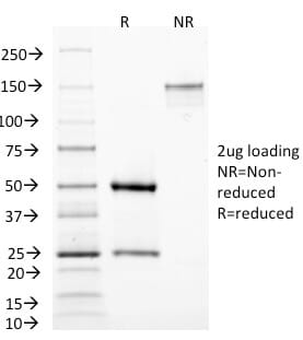 SDS-PAGE analysis of Anti-MAML3 Antibody [MAML3/1303] under non-reduced and reduced conditions; showing intact IgG and intact heavy and light chains, respectively. SDS-PAGE analysis confirms the integrity and purity of the antibody.