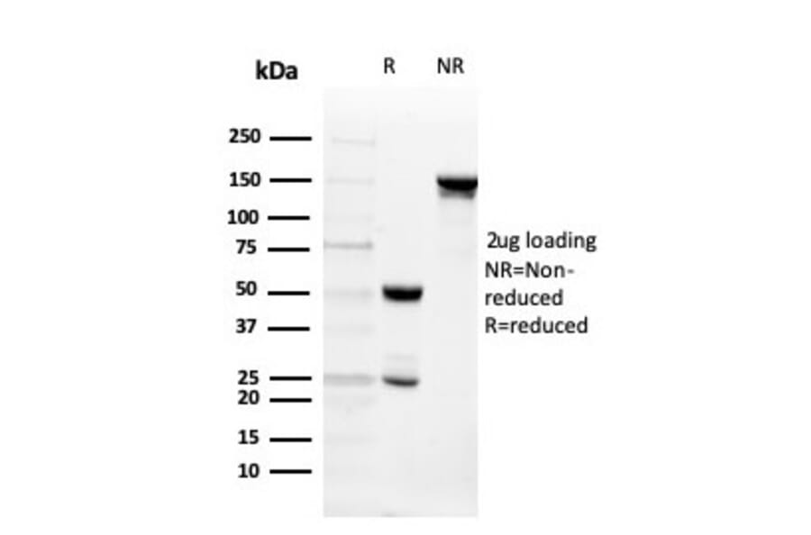 SDS-PAGE - Anti-Intelectin 1 Antibody [ITLN1/4062] - BSA and Azide free (A252896) - Antibodies.com