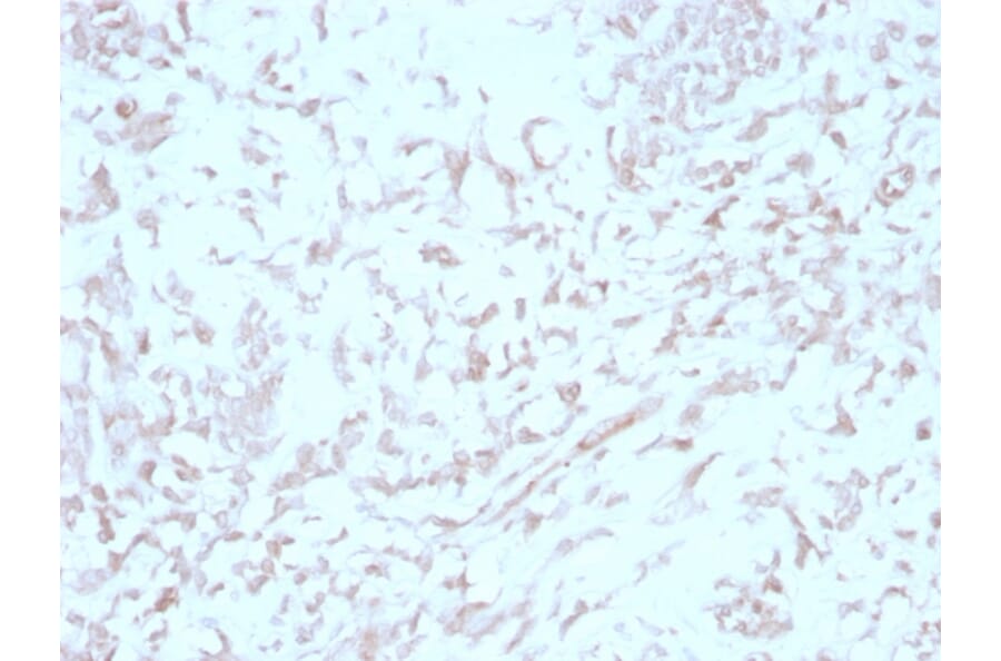 Immunohistochemistry - Anti-Kindlin 1 Antibody [4A5.14] - BSA and Azide free (A252900) - Antibodies.com