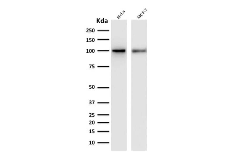 Western Blot - Anti-ENAH Antibody [ENAH/1988] - BSA and Azide free (A252903) - Antibodies.com