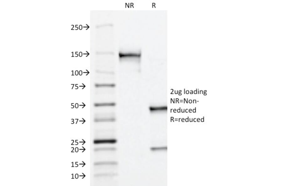 SDS-PAGE - Anti-Prostate Specific Acid Phosphatase Antibody [ACPP/1338] - BSA and Azide free (A249726) - Antibodies.com