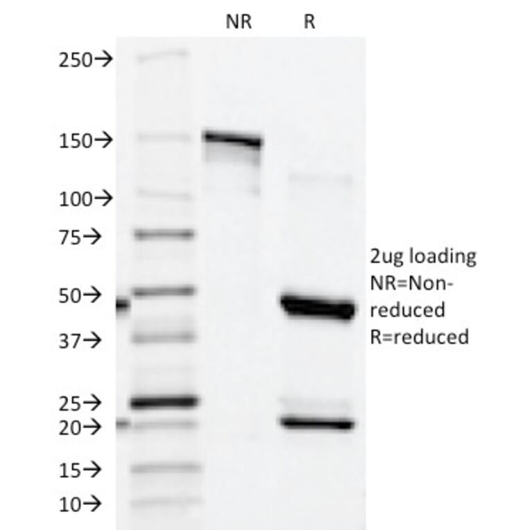 SDS-PAGE - Anti-Prostate Specific Acid Phosphatase Antibody [ACPP/1339] - BSA and Azide free (A252906) - Antibodies.com