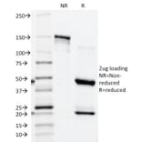 SDS-PAGE - Anti-Prostate Specific Acid Phosphatase Antibody [ACPP/1339] - BSA and Azide free (A252906) - Antibodies.com