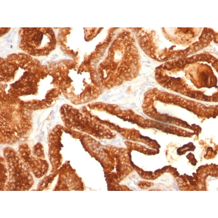 Immunohistochemistry - Anti-Prostate Specific Acid Phosphatase Antibody [SPM312] - BSA and Azide free (A252908) - Antibodies.com