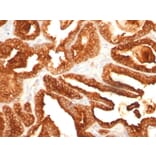 Immunohistochemistry - Anti-Prostate Specific Acid Phosphatase Antibody [SPM312] - BSA and Azide free (A252908) - Antibodies.com