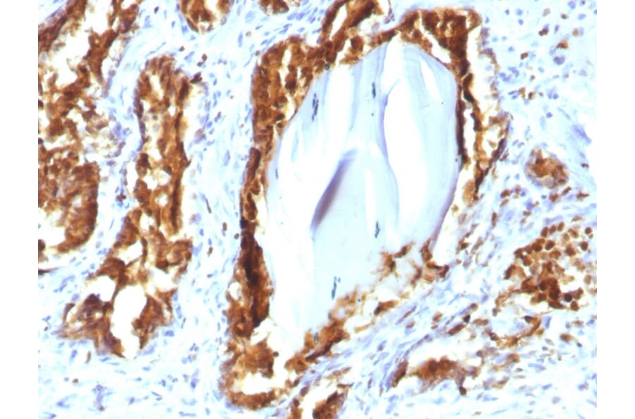 Immunohistochemistry - Anti-Prostate Specific Acid Phosphatase Antibody [rACPP/1338] - BSA and Azide free (A249730) - Antibodies.com