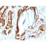 Immunohistochemistry - Anti-Prostate Specific Acid Phosphatase Antibody [rACPP/1338] - BSA and Azide free (A249730) - Antibodies.com