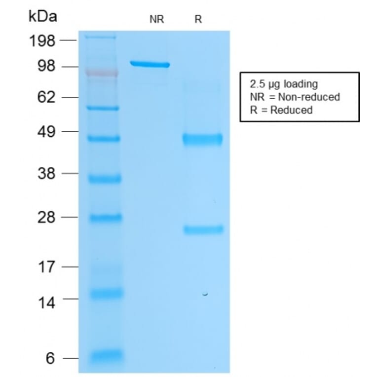 SDS-PAGE - Anti-Prostate Specific Acid Phosphatase Antibody [rACPP/1338] - BSA and Azide free (A249730) - Antibodies.com