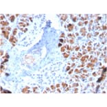 Immunohistochemistry - Anti-BARX1 Antibody [BARX1/2759] - BSA and Azide free (A252910) - Antibodies.com