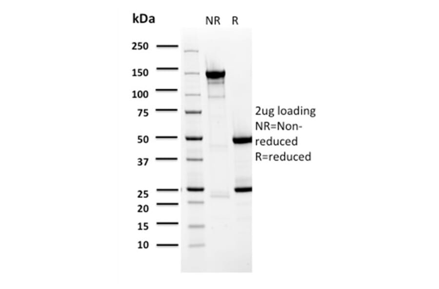 SDS-PAGE - Anti-BARX1 Antibody [BARX1/2759] - BSA and Azide free (A252911) - Antibodies.com