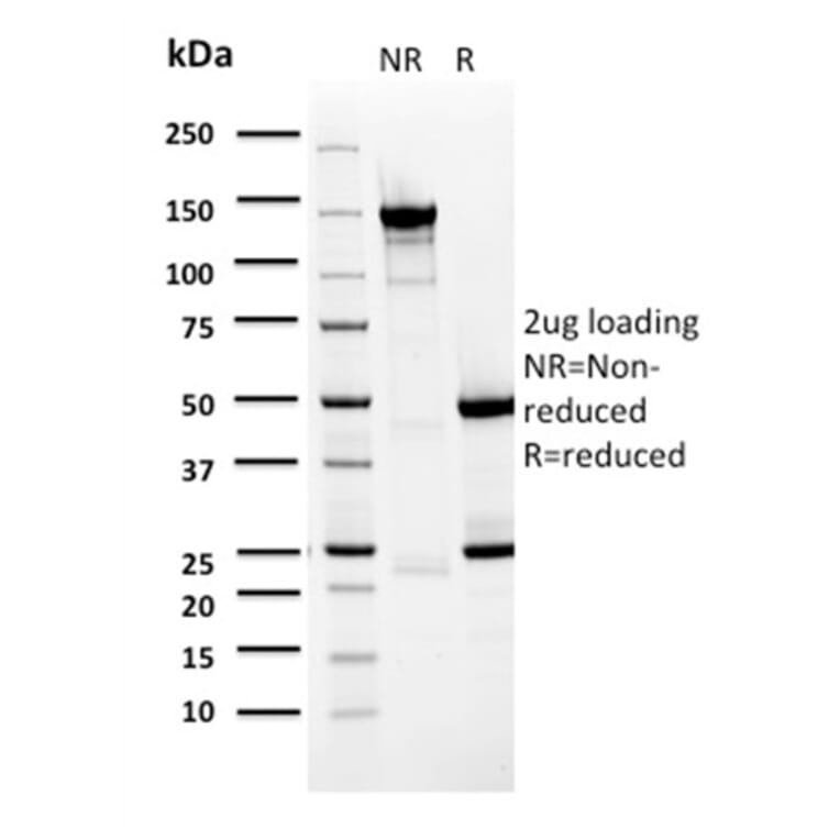SDS-PAGE - Anti-BARX1 Antibody [BARX1/2759] - BSA and Azide free (A252911) - Antibodies.com