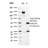 SDS-PAGE - Anti-BARX1 Antibody [BARX1/2759] - BSA and Azide free (A252911) - Antibodies.com