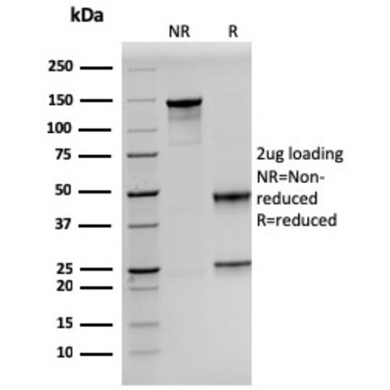 SDS-PAGE - Anti-Prolactin Antibody [PRL/2641] - BSA and Azide free (A252913) - Antibodies.com