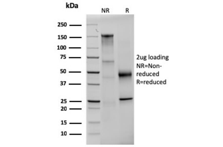 SDS-PAGE - Anti-Prolactin Antibody [PRL/2642] - BSA and Azide free (A252914) - Antibodies.com