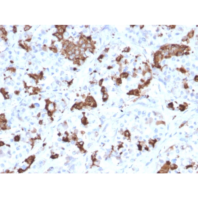 Immunohistochemistry - Anti-Prolactin Antibody [PRL/2644] - BSA and Azide free (A252916) - Antibodies.com