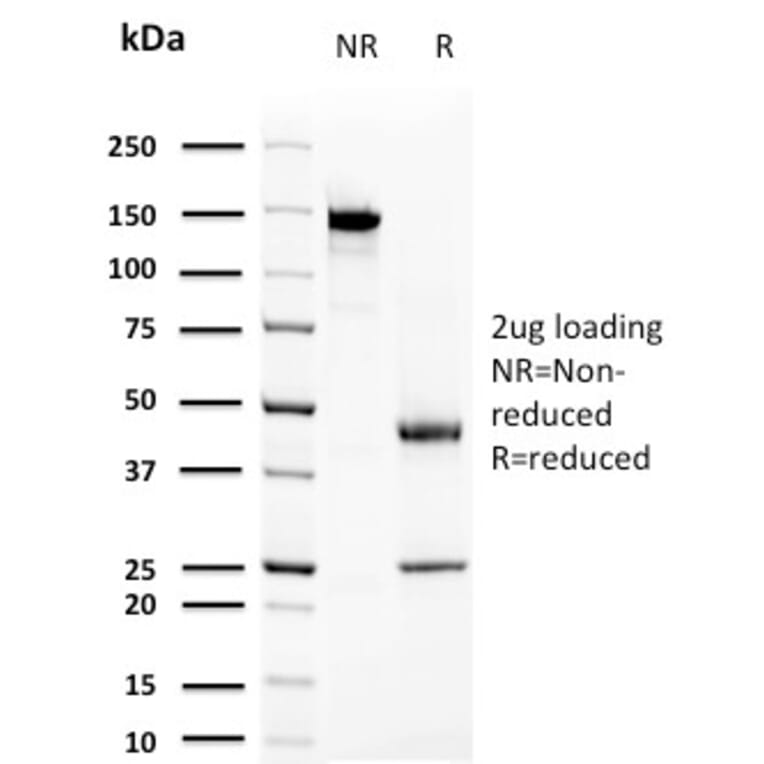 SDS-PAGE - Anti-Prolactin Antibody [PRL/2644] - BSA and Azide free (A252916) - Antibodies.com